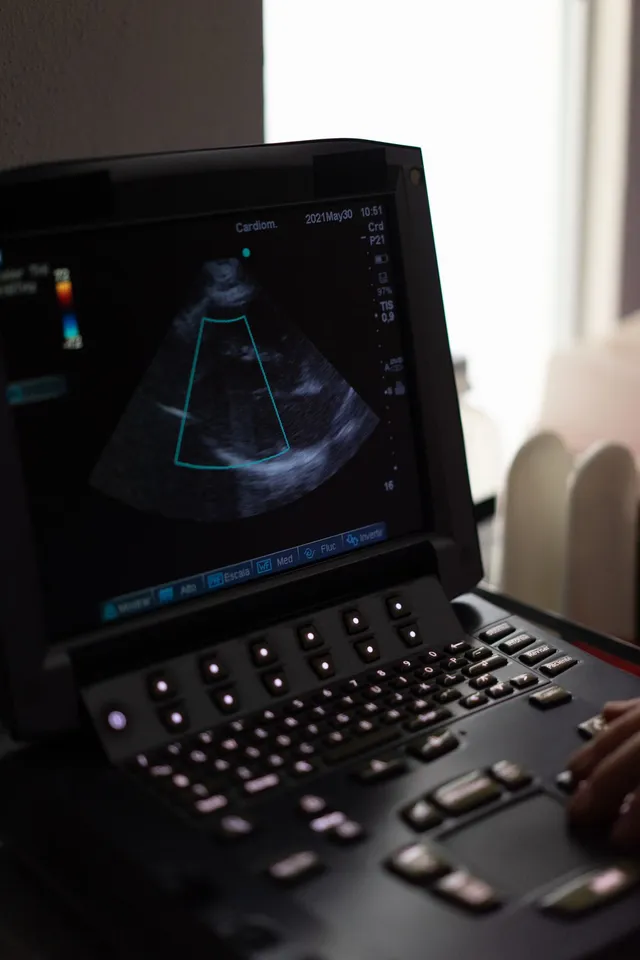 2 D Echocardiography