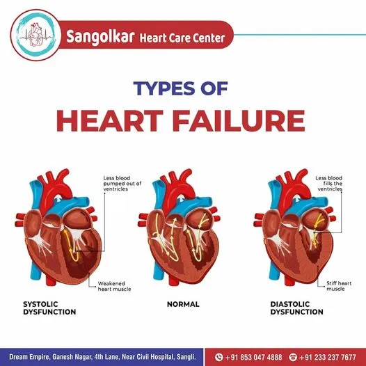 Heart-health awareness poster 5 (Marathi) from Sangolkar Heart Care Center